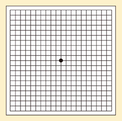 格子状の線の中心に黒い点が書かれた画像