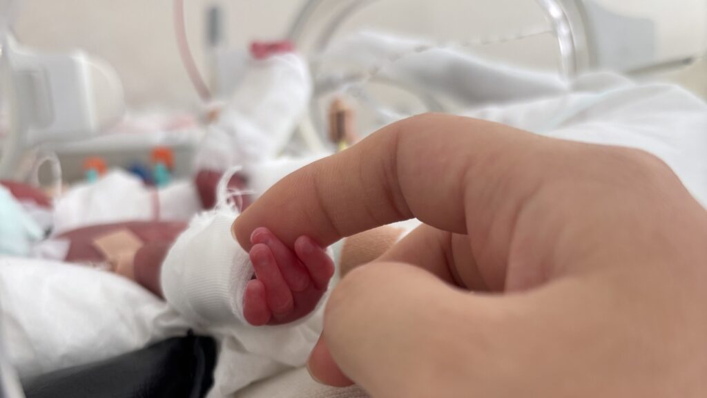 NICUの保育器の中の、細く小さな手が高橋さんの右手人差し指の先を握っている。指三本で第一関節のサイズと同じくらいの小ささ。